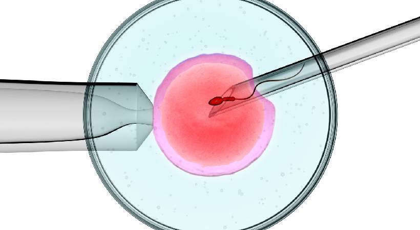 IVF treatment in baner