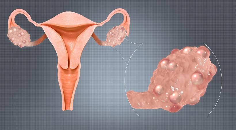 Gynecologist in Baner, Pune